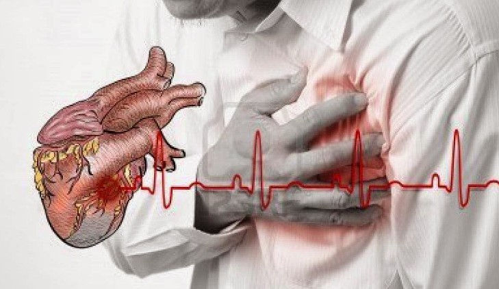 Apa Saja Gejala Awal Penyakit Jantung Koroner